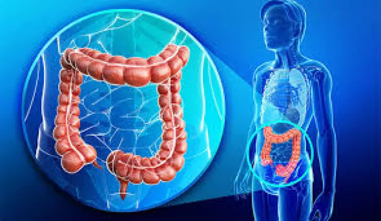 Semne ale cancerului colorectal